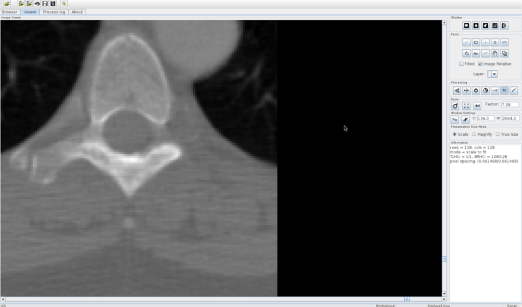The elfcom.dcm file is loaded without error in the DICOMscope application.
